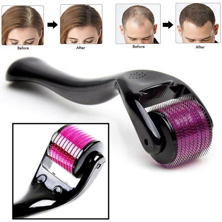 Derma Roller for Face & Hair Growth – 0.5mm Microneedle Skin Therapy Tool for Acne Scars, Beard & Hair Regrowth